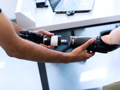 Un braccio artificiale per bere e mangiare, la tecnologia rivoluziona la vita dei disabili